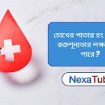 চোখের পাতার রং এবং রক্তশূন্যতা