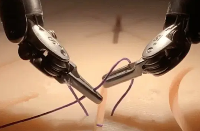 If there is any mistake in robotic surgery, the robot can correct it on its own